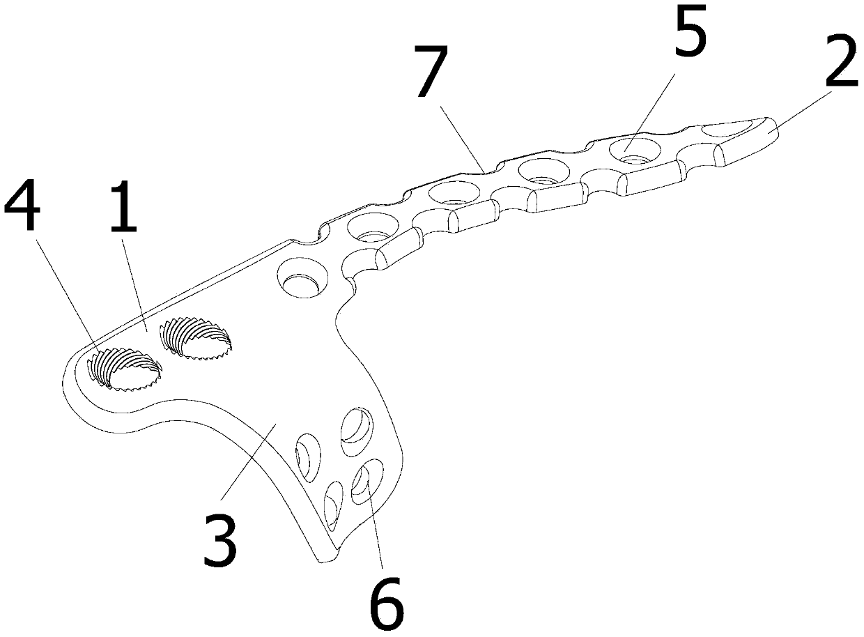 Acetabulum parastyle and posterior column united steel plate