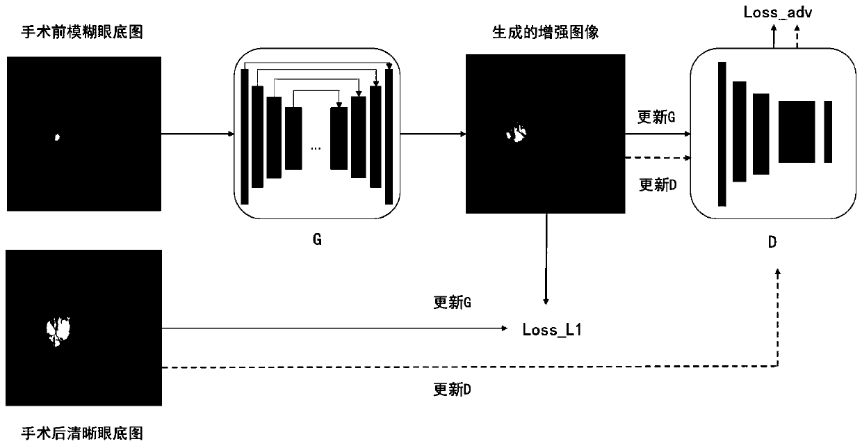 Fuzzy retina fundus image enhancement method based on generative adversarial network