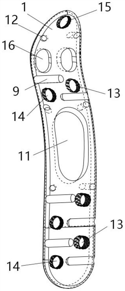 Thighbone greater trochanter protection steel plate