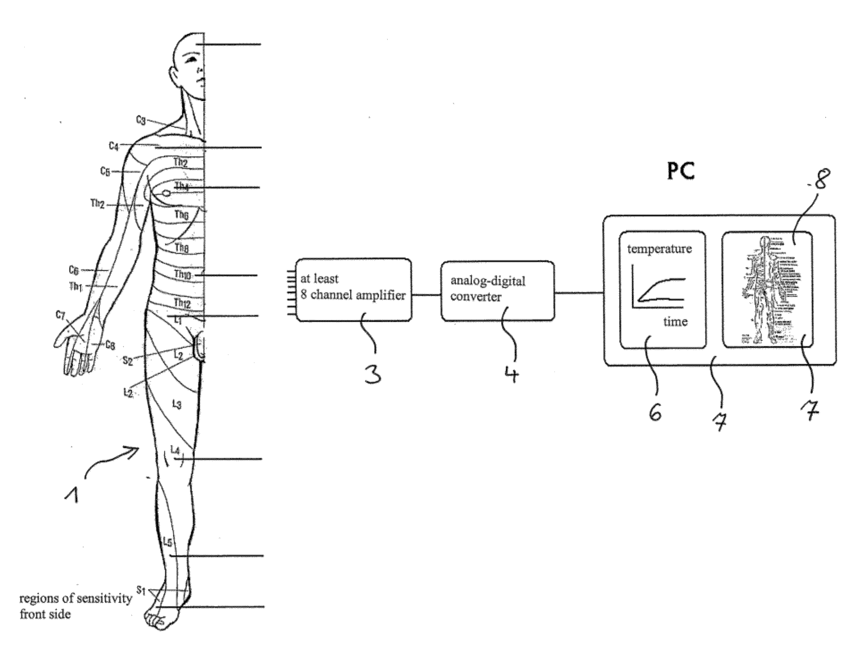 Device and method for monitoring the success of spinal anesthesia