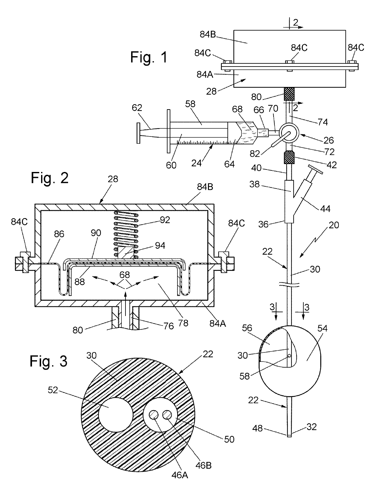 Systems and methods for effecting the total and partial occlusion of the aorta of a living being