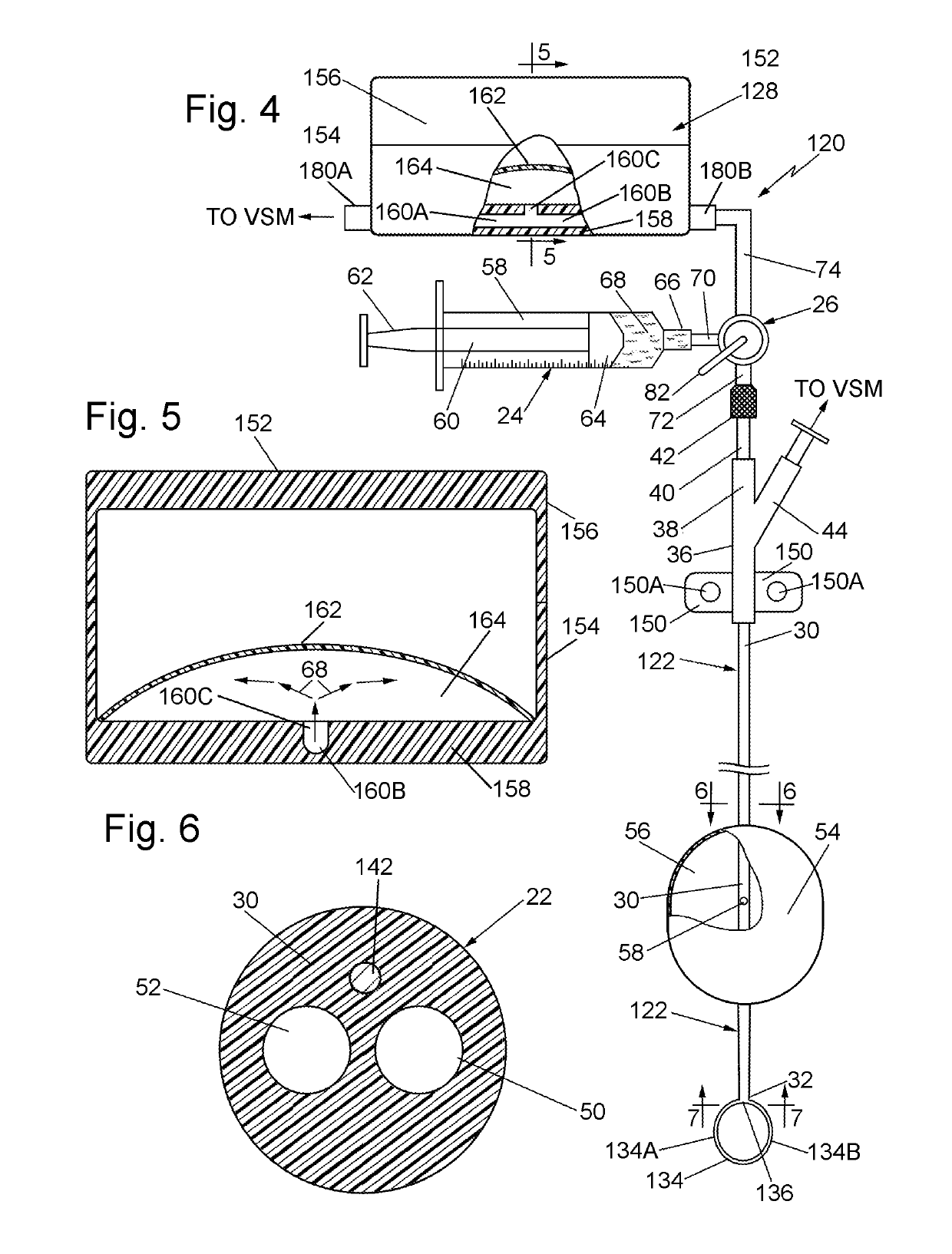 Systems and methods for effecting the total and partial occlusion of the aorta of a living being