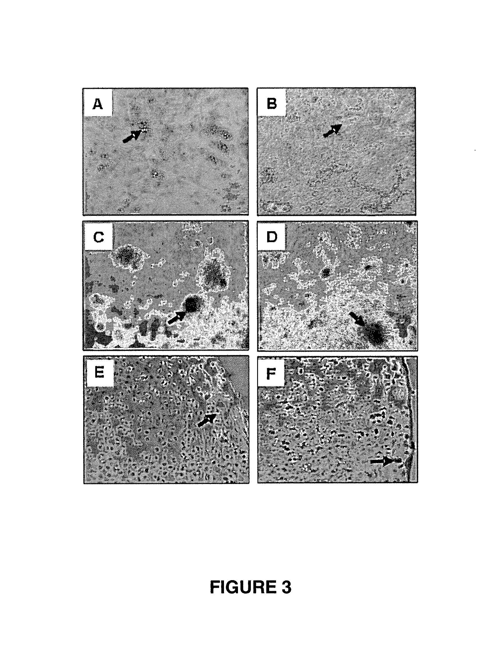 Monoclonal antibody STRO-4