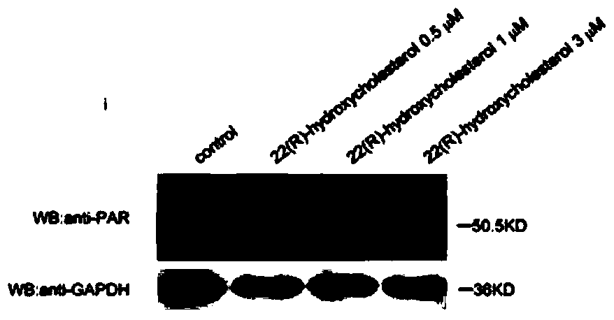 Use of 22(r)-hydroxycholesterol as a PARP1 inhibitor