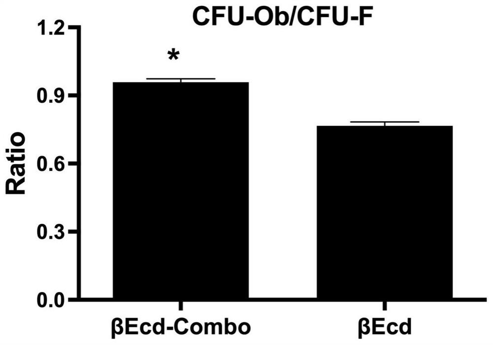 Composition for preventing and/or treating osteoporosis