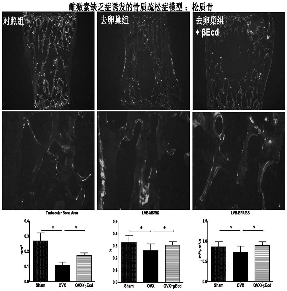 Composition for preventing and/or treating osteoporosis