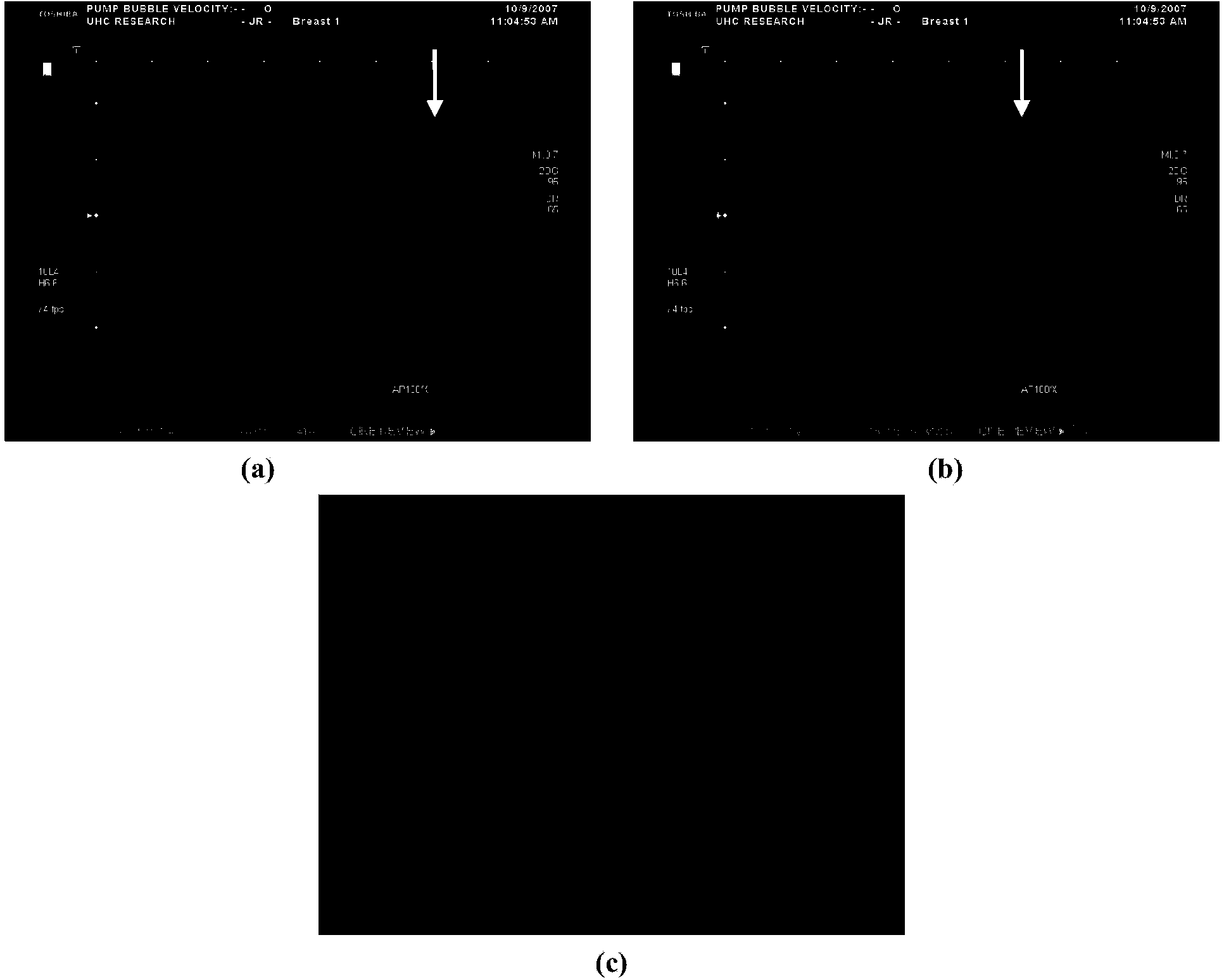 Method for measuring blood flow velocity by utilization of radiography microbubbles