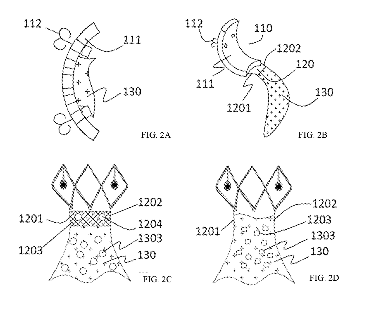 Prosthesis for preventing valve regurgitation