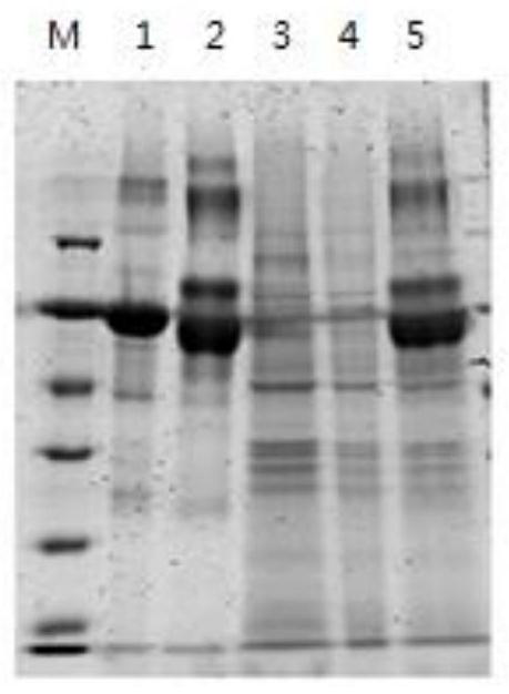 Composite siRNA nanocarrier and its preparation method and application