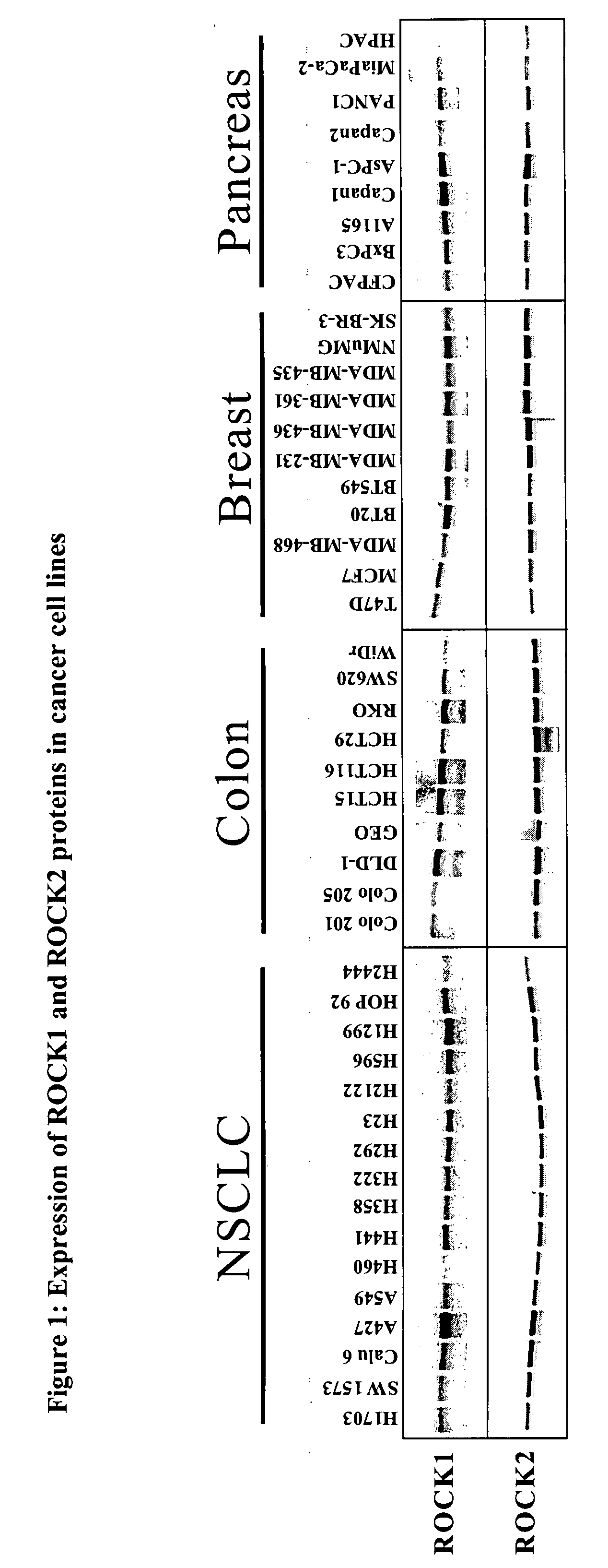 Method for the assay of rock kinase activity in cells