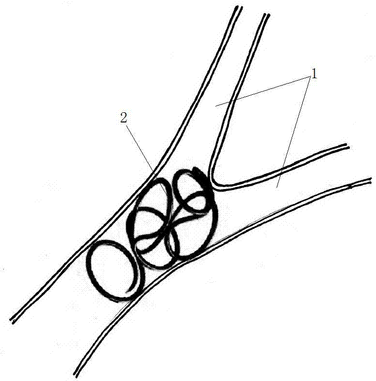 Catching device for foreign matter in blood vessel and catching method thereof