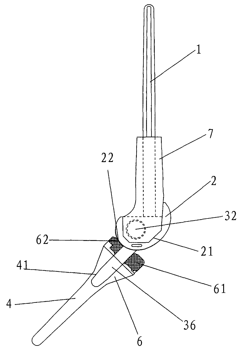 New Axial Knee Prosthesis