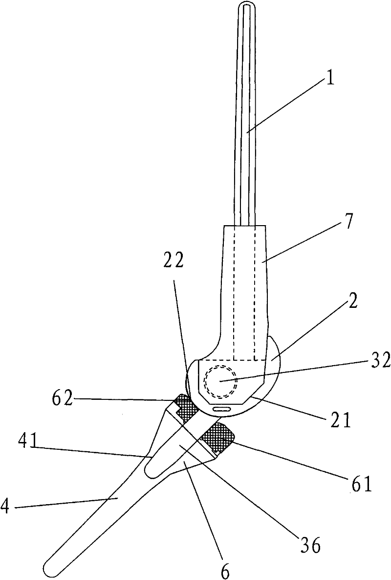 New Axial Knee Prosthesis