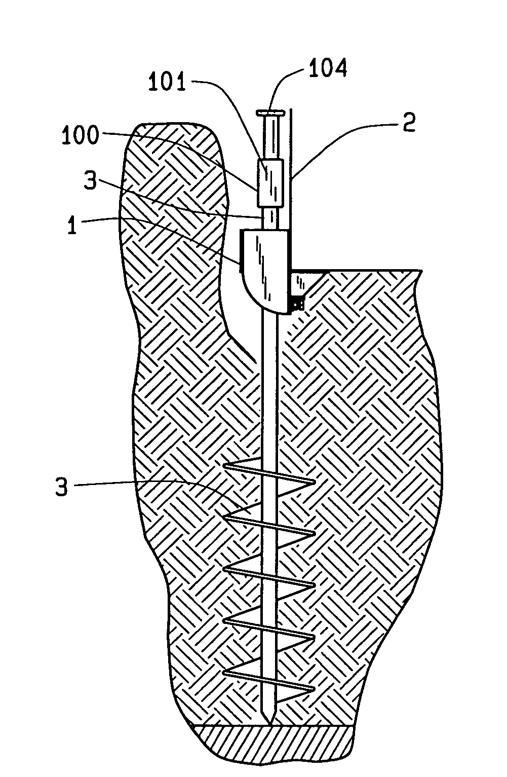 Bracket assembly for lifting and supporting a foundation