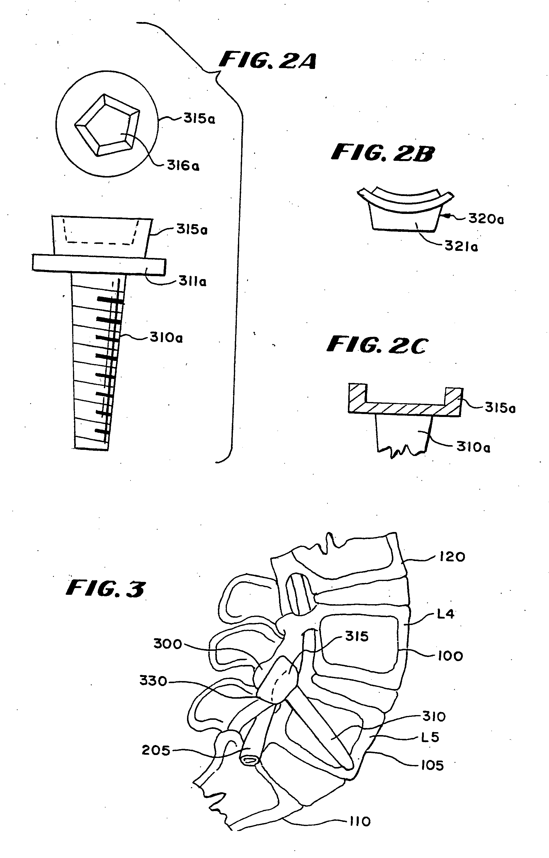 Facet arthroplasty devices and methods