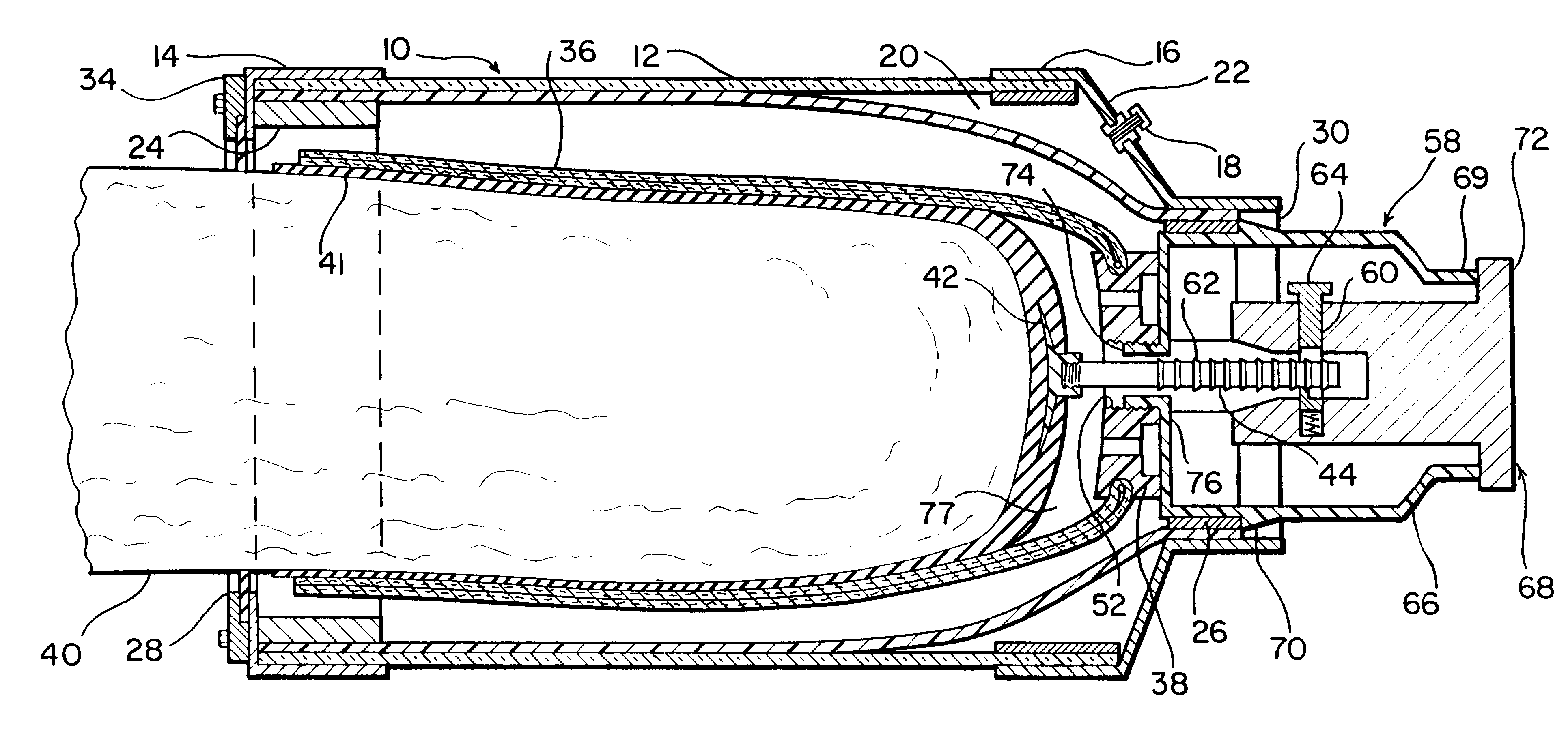 Method for making prosthetic residual limb socket