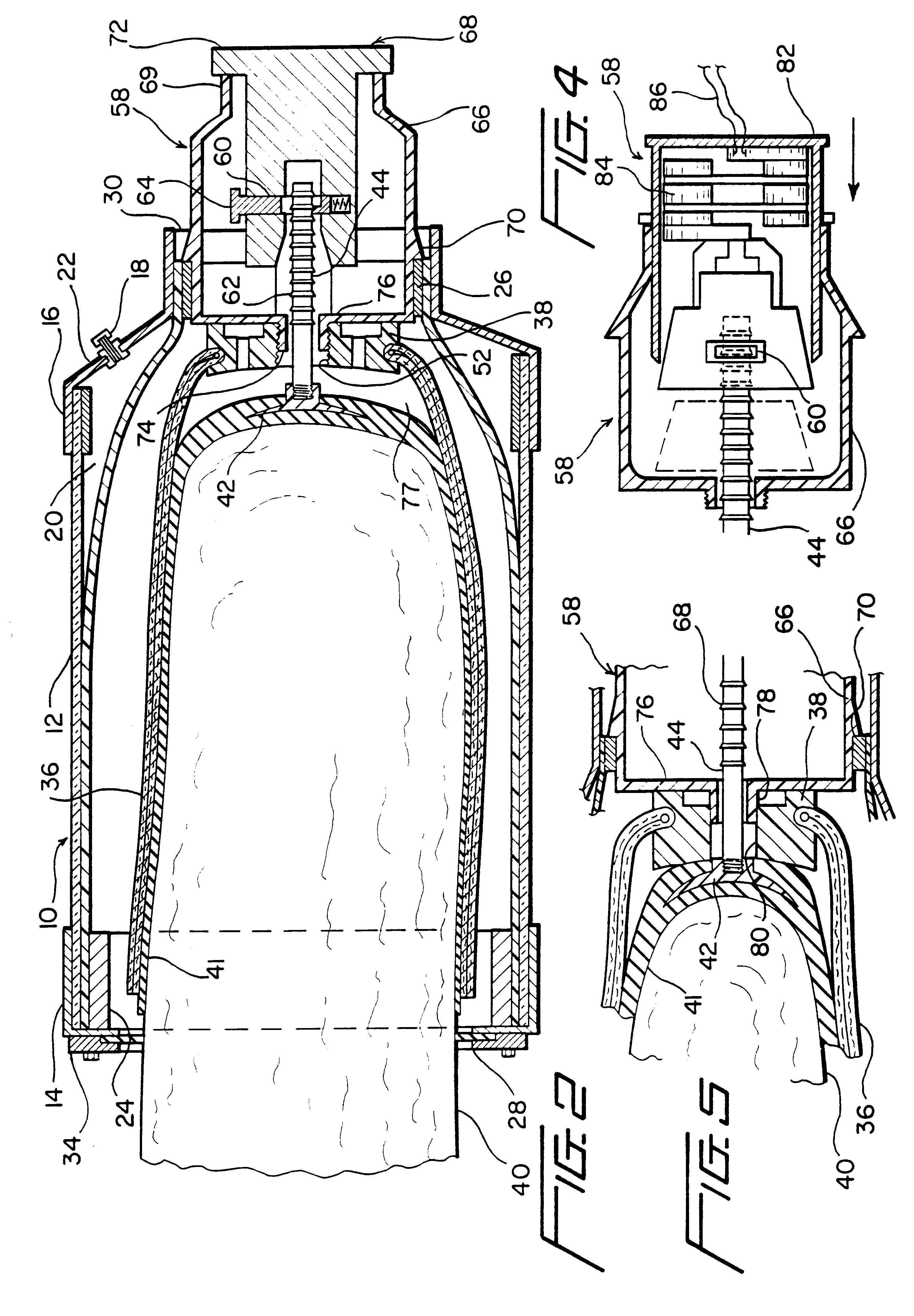 Method for making prosthetic residual limb socket