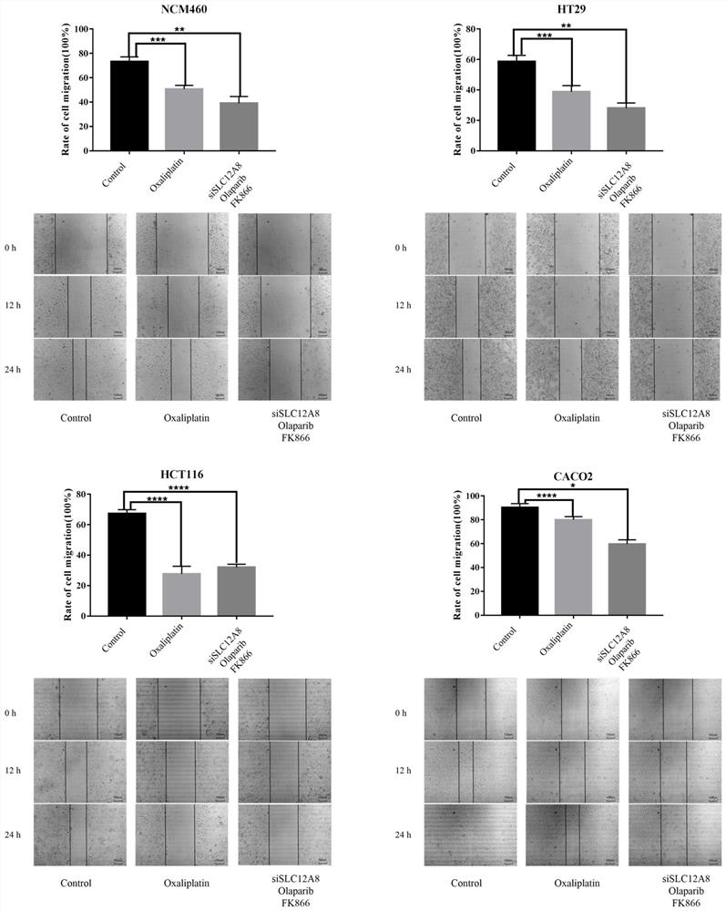 Novel method for inhibiting colon cancer cell activity by combining inhibitor with small interfering RNA