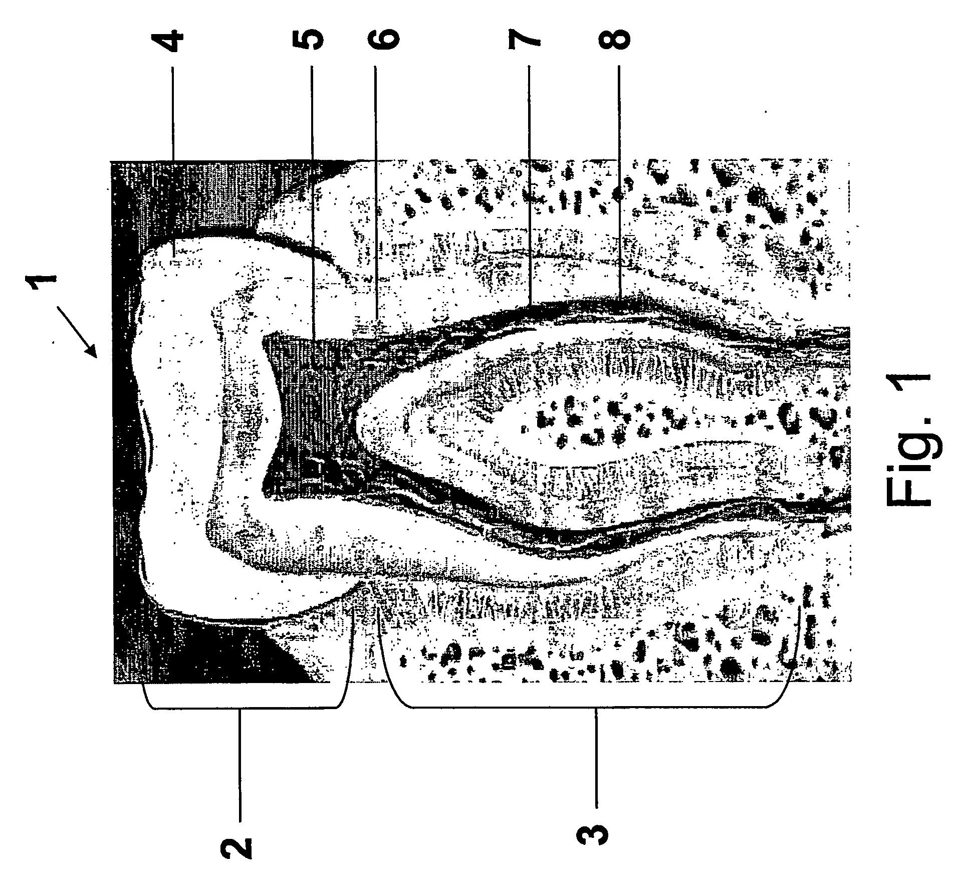 Self adjusting instrument