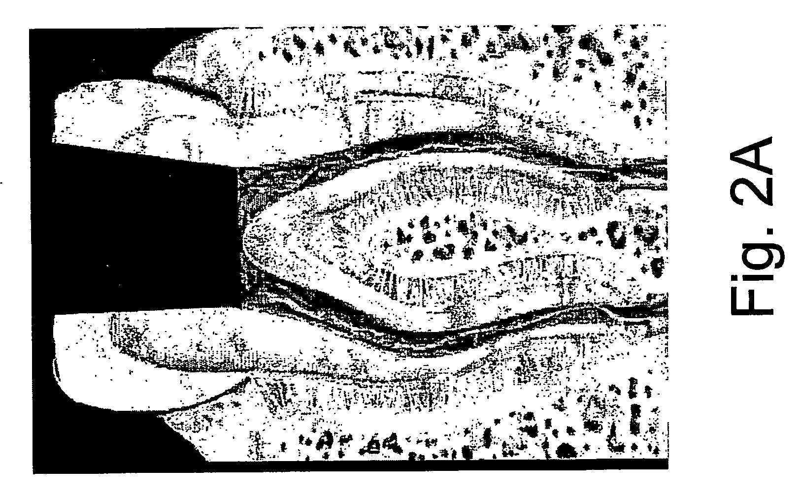 Self adjusting instrument