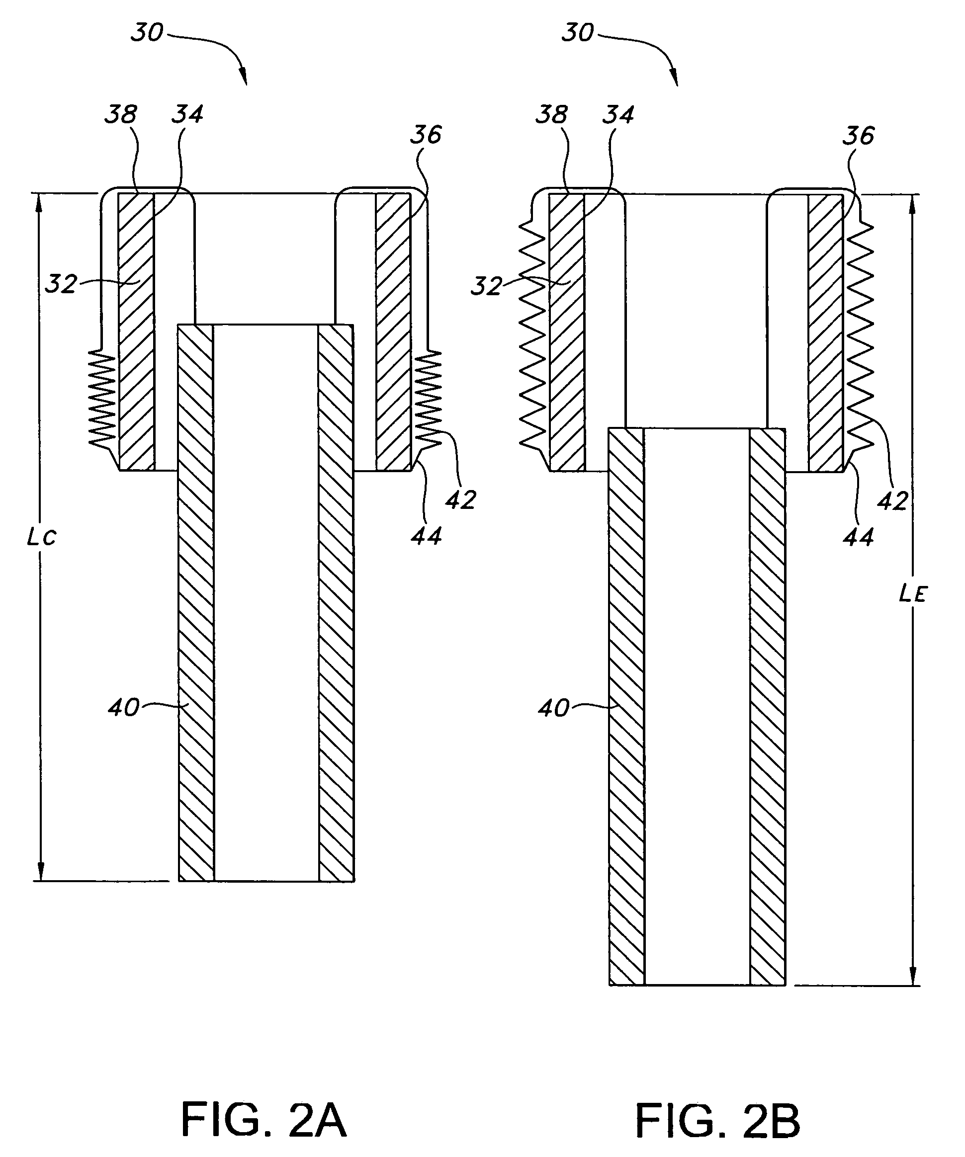 Variable length endovascular graft prosthesis adapted to prevent endoleaks