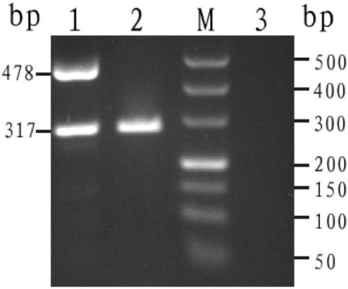 PCR amplification primer set, amplification reagent and kit for rapidly detecting Thailand alpha-thalassemia