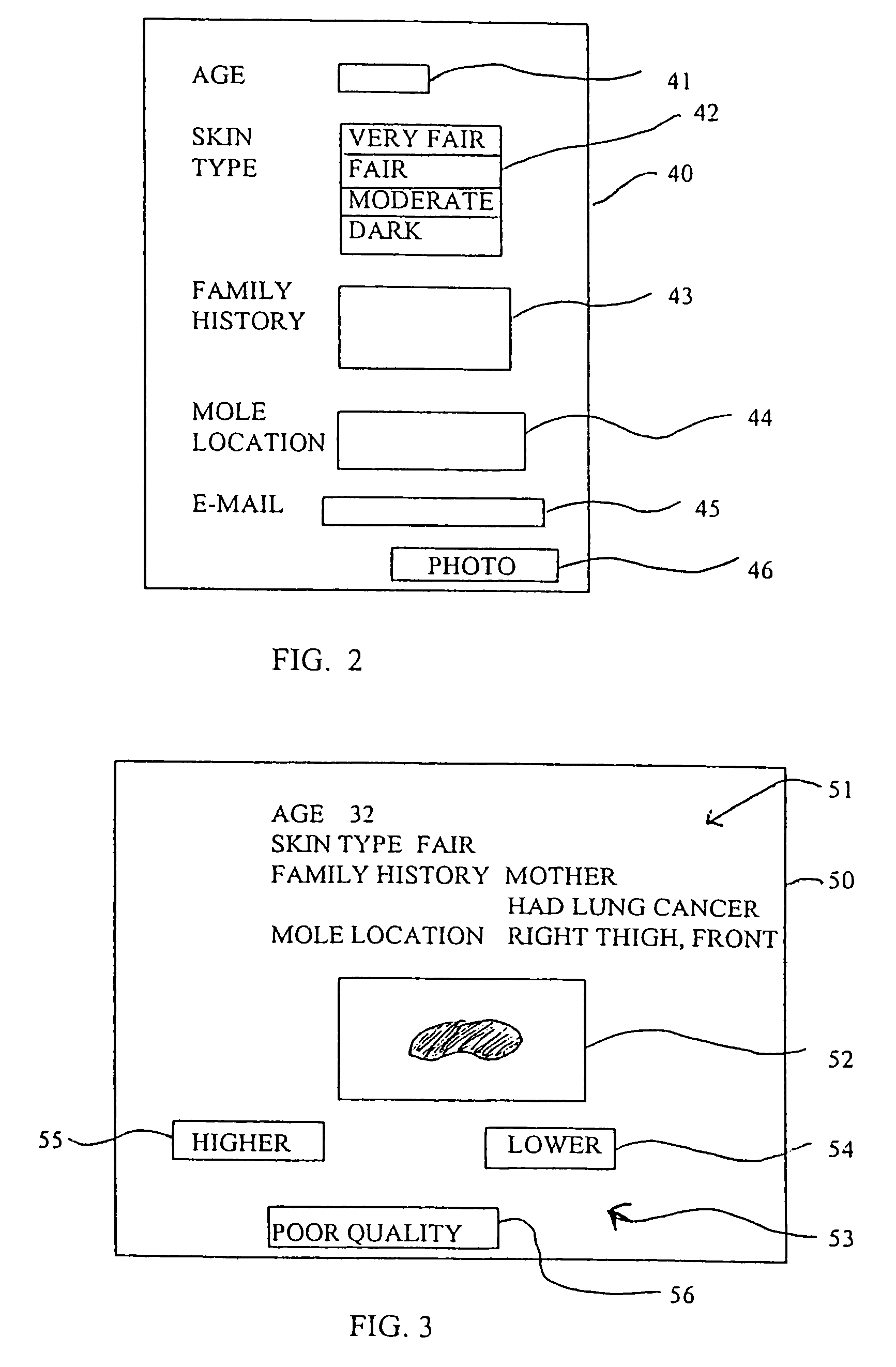 Method and device for skin cancer screening