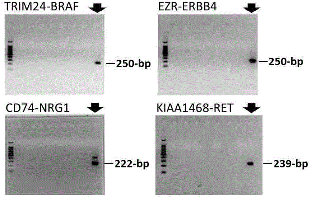 New fusion gene detected in lung cancer