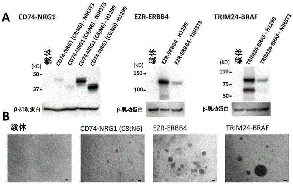 New fusion gene detected in lung cancer