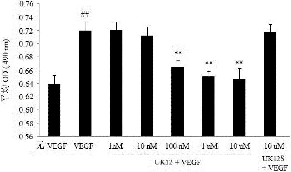 New small peptides for inhibiting newborn blood vessels, and application thereof