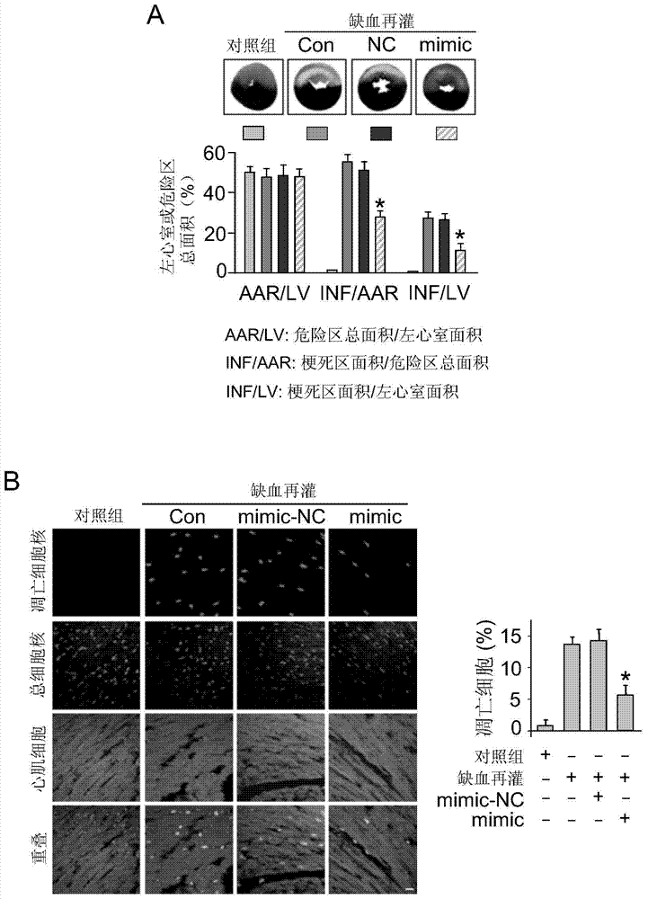 Pharmaceutical composition containing miRNA-324 and application of pharmaceutical composition