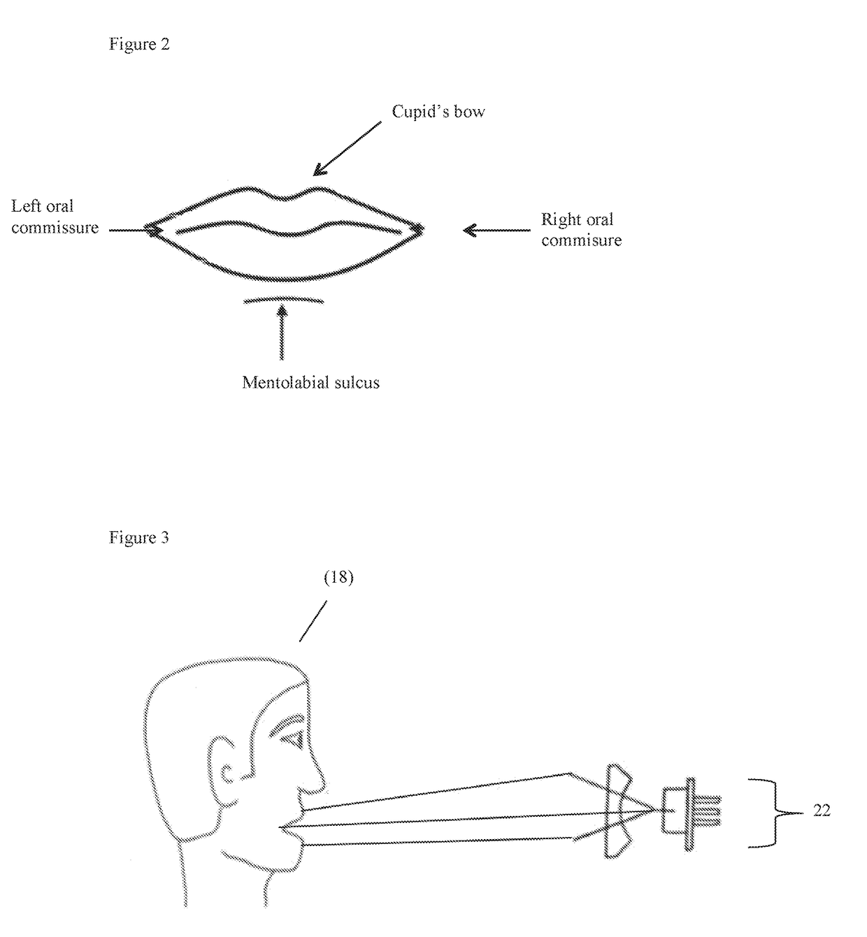 System for filtering potential immigration threats through speech analysis