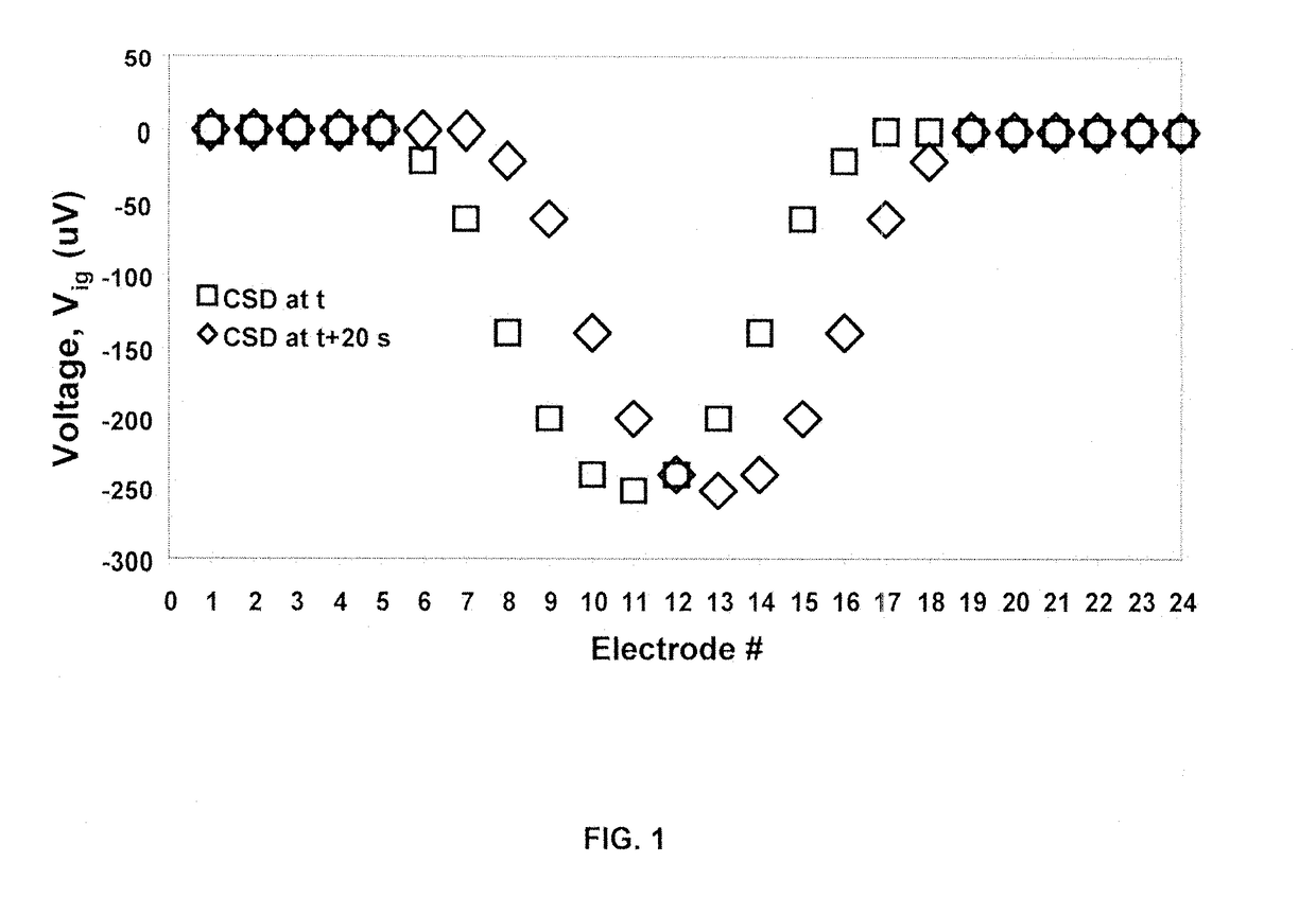 Non-invasive Systems and Methods to Detect Cortical Spreading Depression for the Detection and Assessment of Brain Injury and Concussion