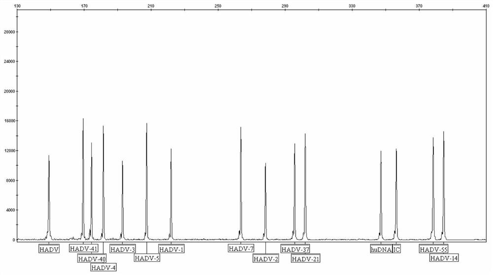 Capillary-electrophoresis-based adenovirus typing detection kit and use method therefor