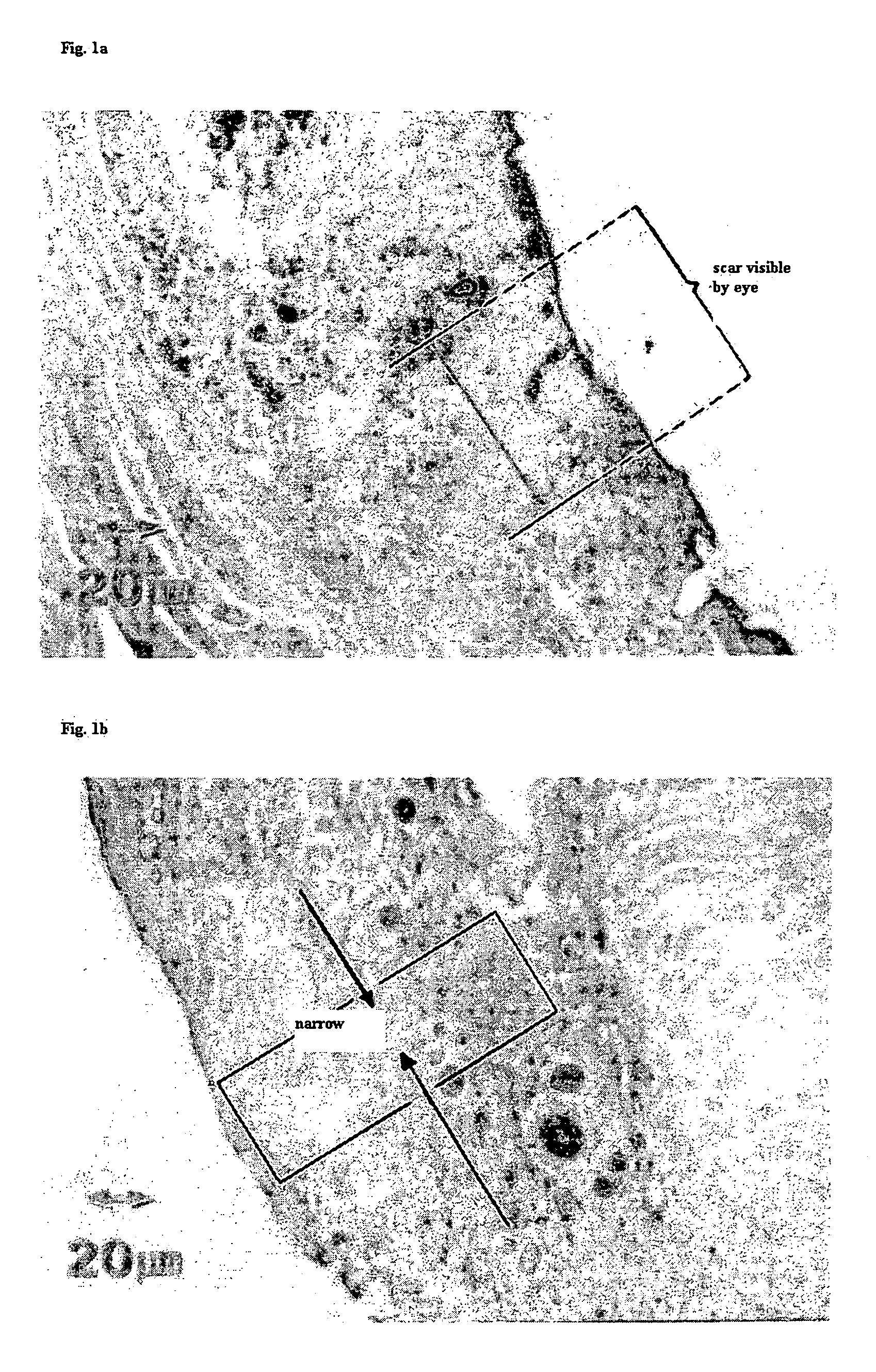 Agent for reduction of scar formation by using wound alkalinization