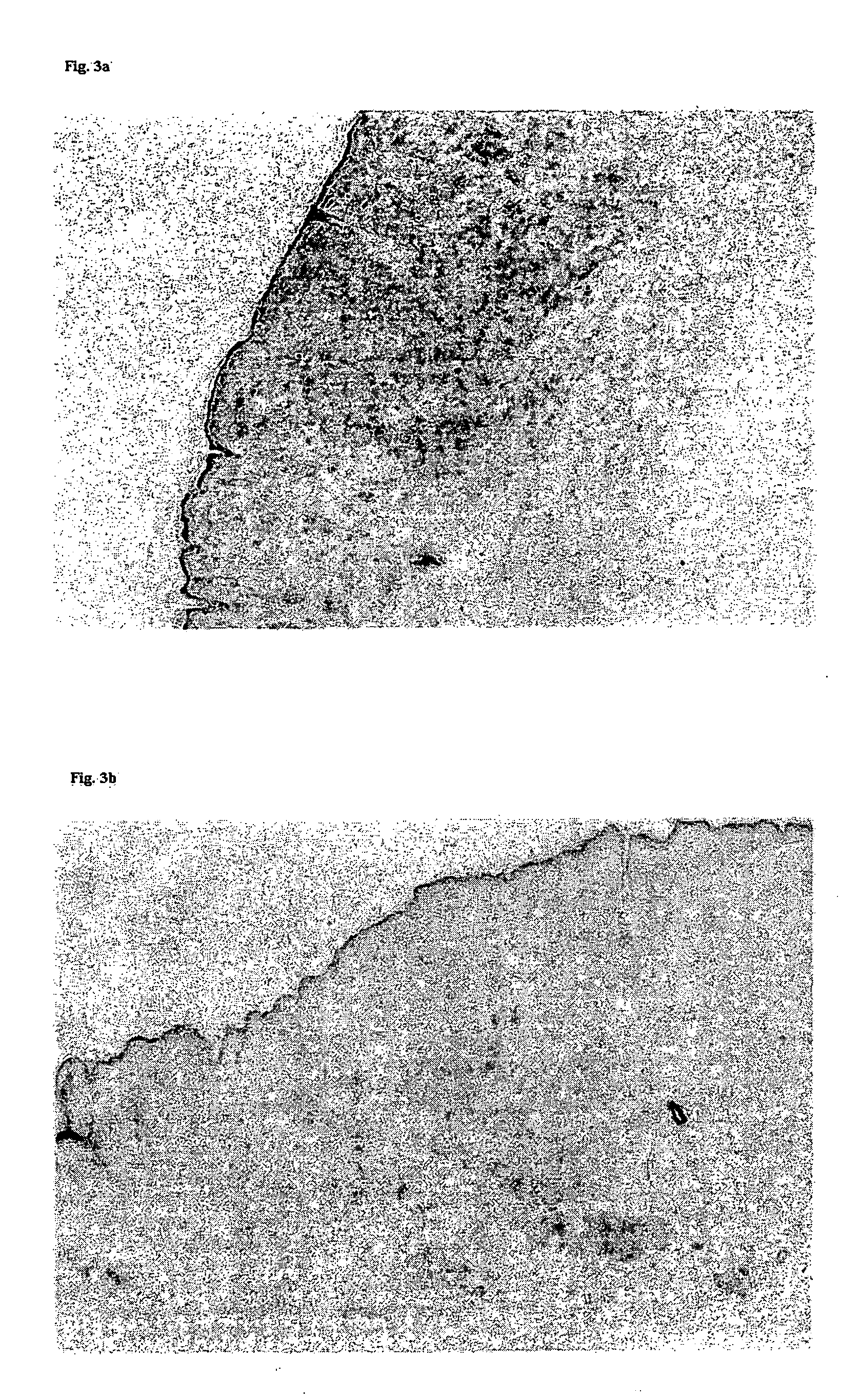 Agent for reduction of scar formation by using wound alkalinization