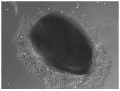 Epidermal cell culture medium and method for preparing fibroblasts and epidermal cells based on same tissue, and application thereof