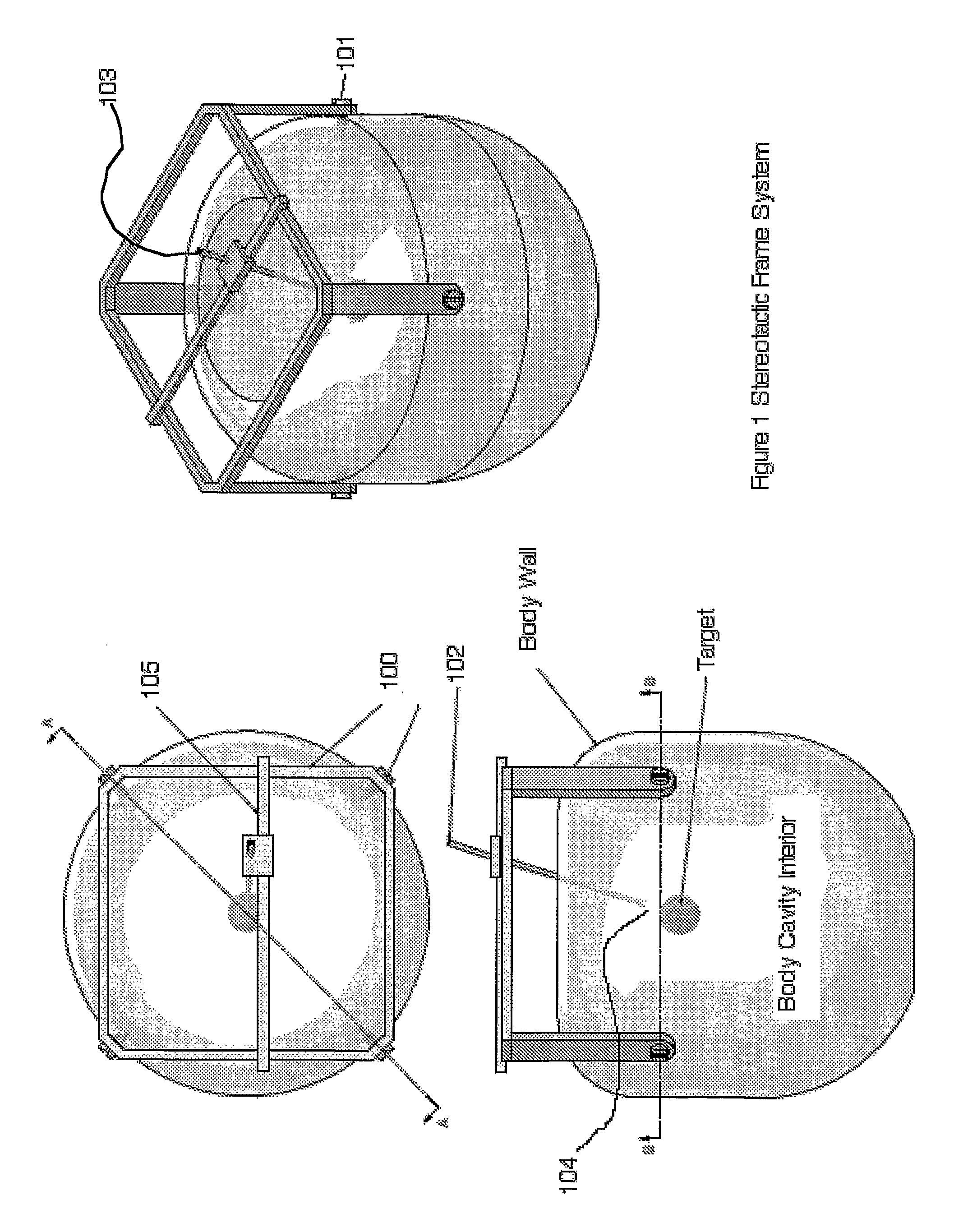 Percutaneous medical devices and methods