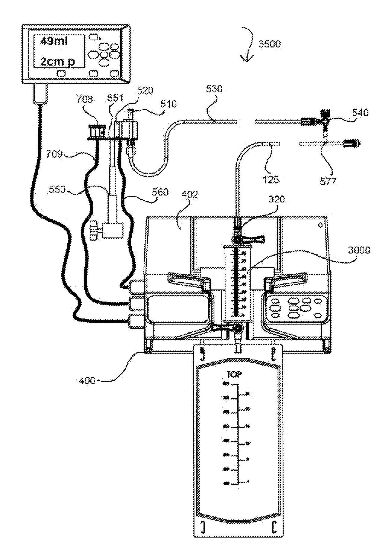 Apparatus and method for bedside collection of body fluids and automatic volume level monitoring