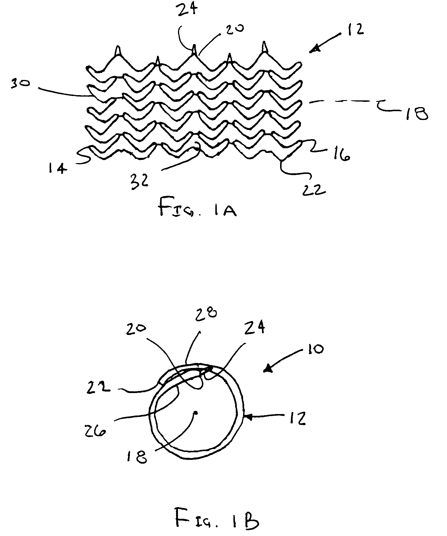 Flexible, stretchable coiled-sheet stent