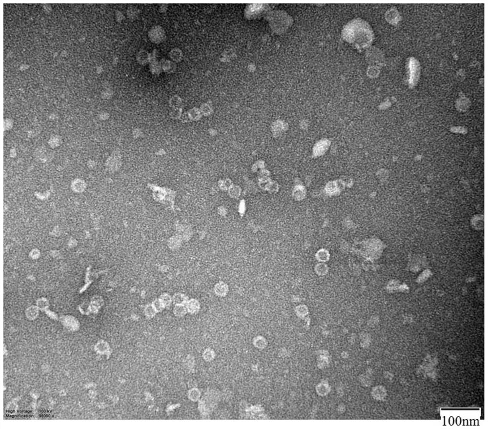 Swine fever antigen epitope peptide and use thereof