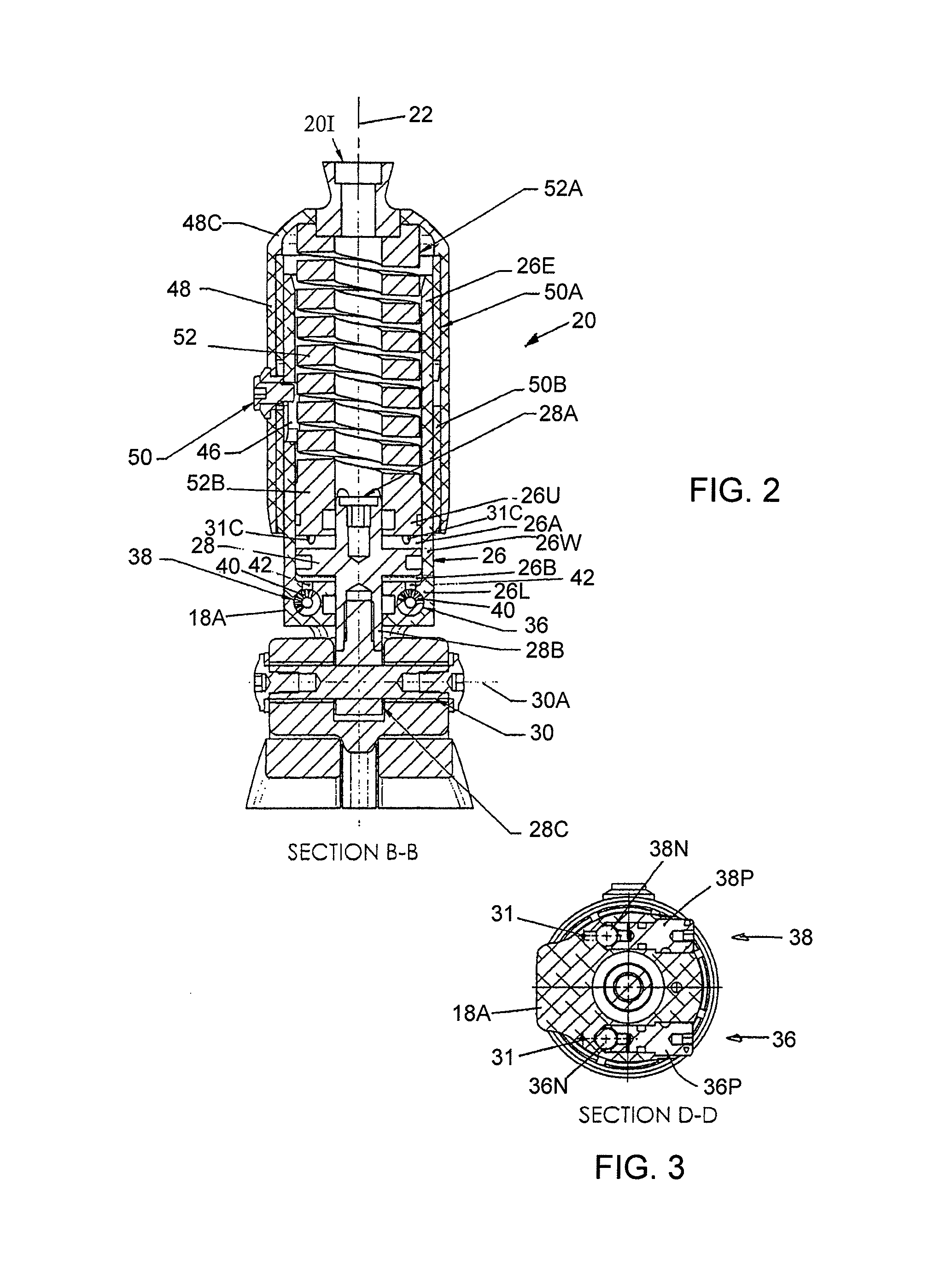 Lower limb prosthesis