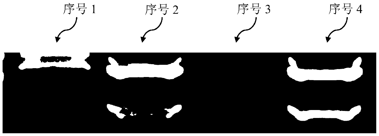 Preserving fluid for biological sample nucleic acid detection and application thereof