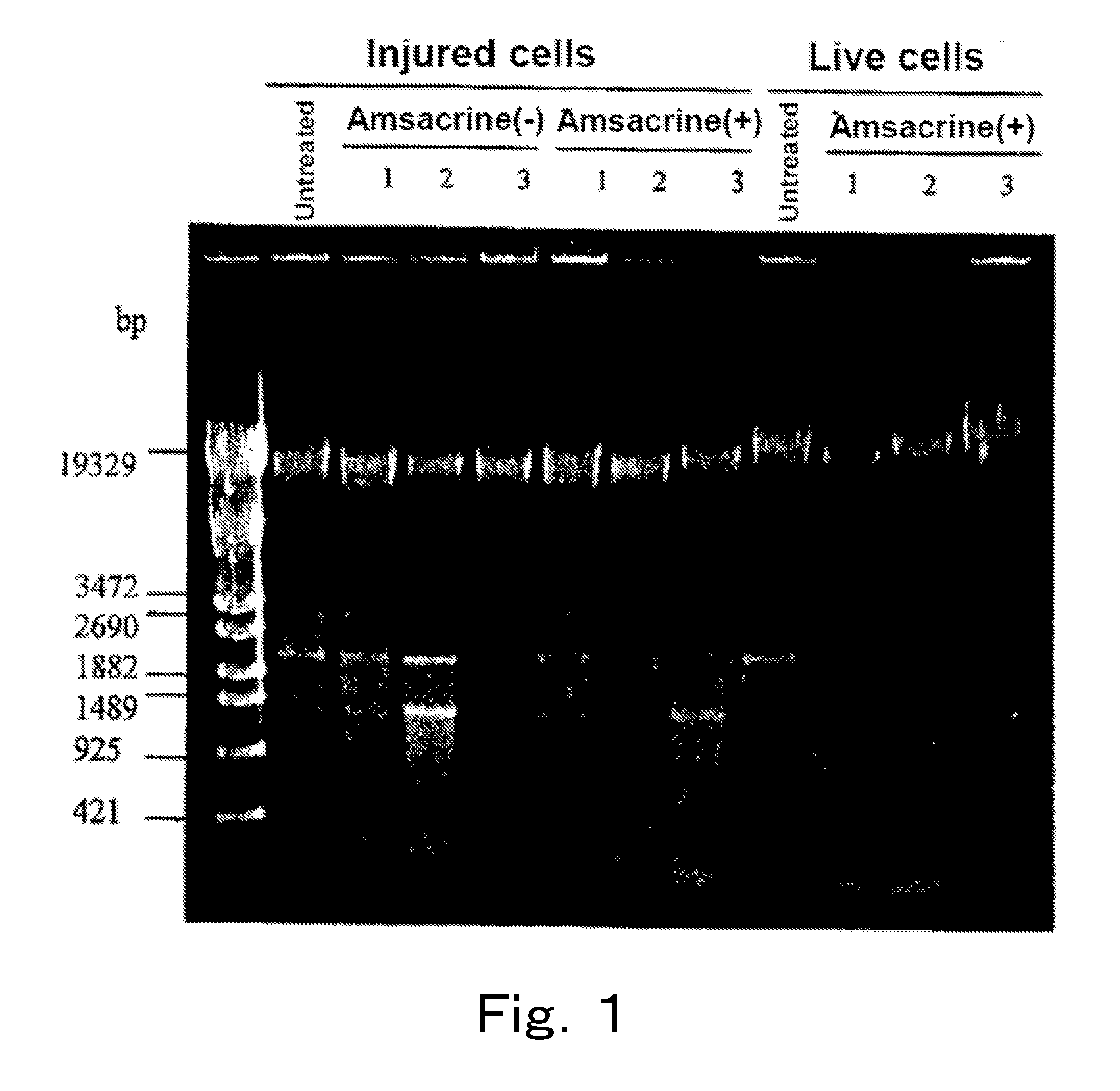 Method for detection of microorganism and kit for detection of microorganism