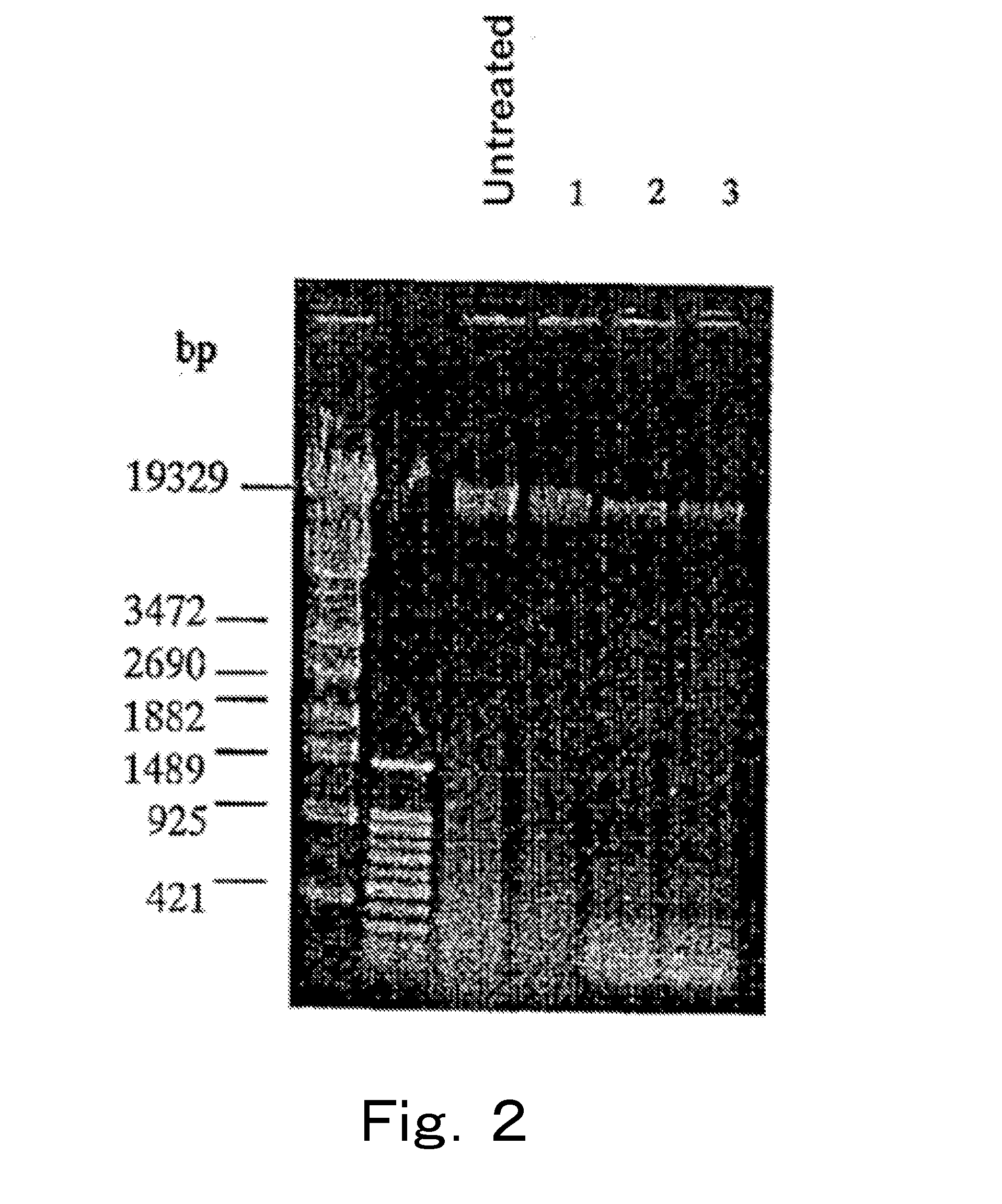 Method for detection of microorganism and kit for detection of microorganism