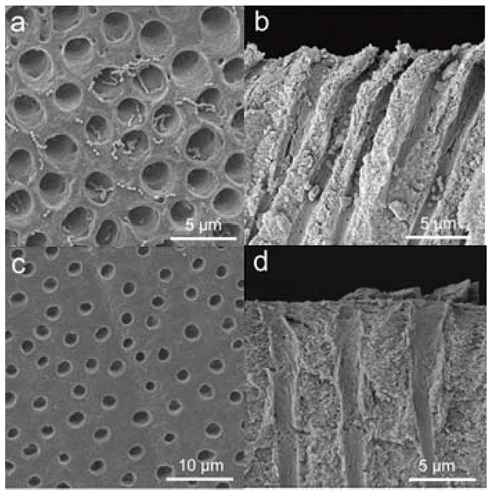 A tooth desensitizer for deep sealing of dental tubules and prevention of biofilm formation