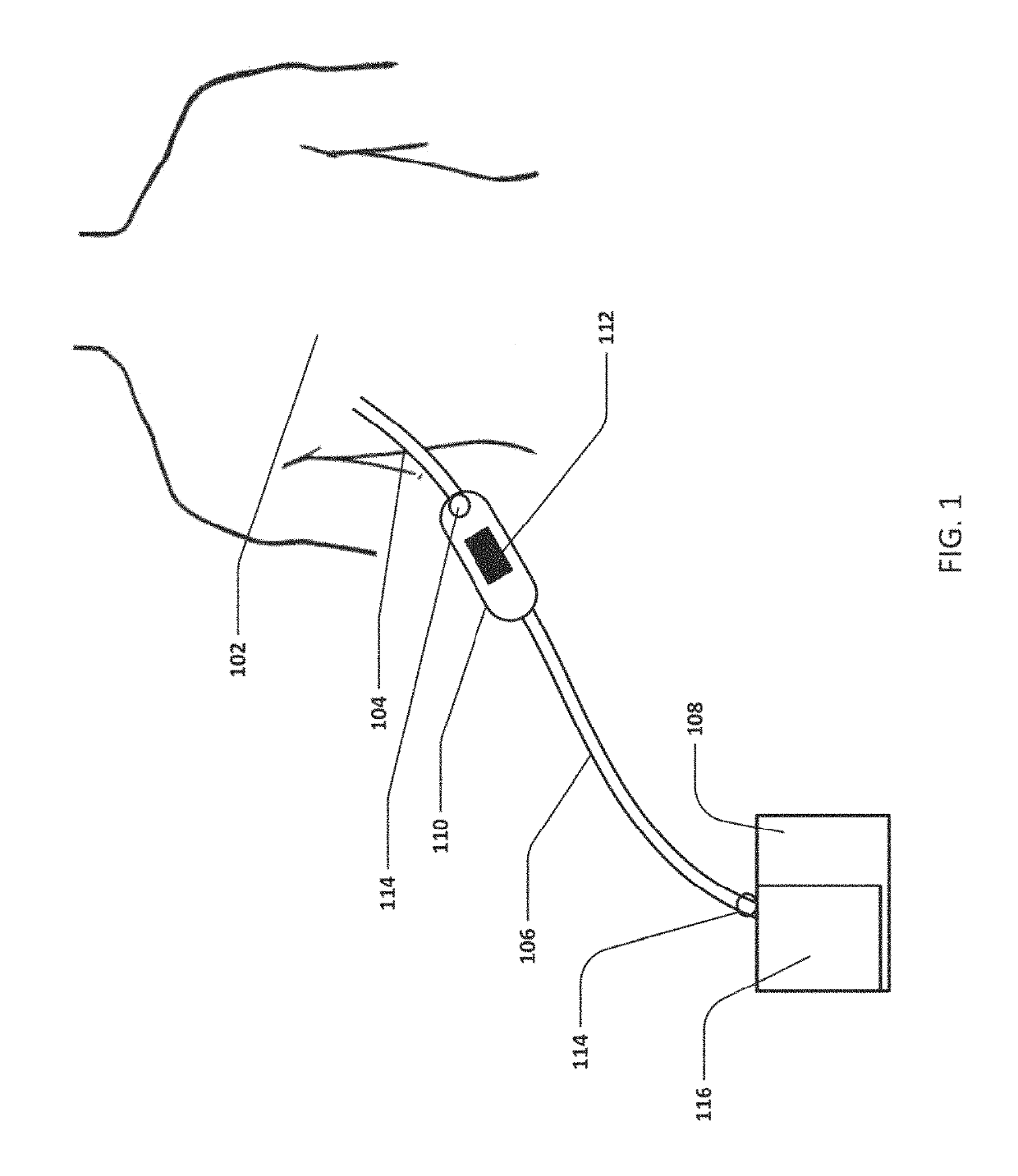 Devices and methods for managing chest drainage