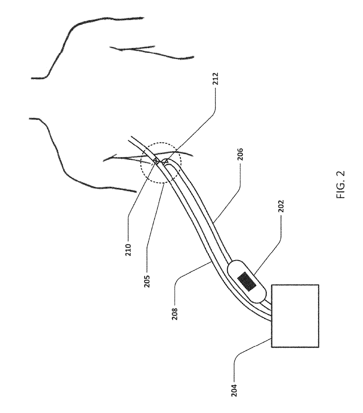 Devices and methods for managing chest drainage