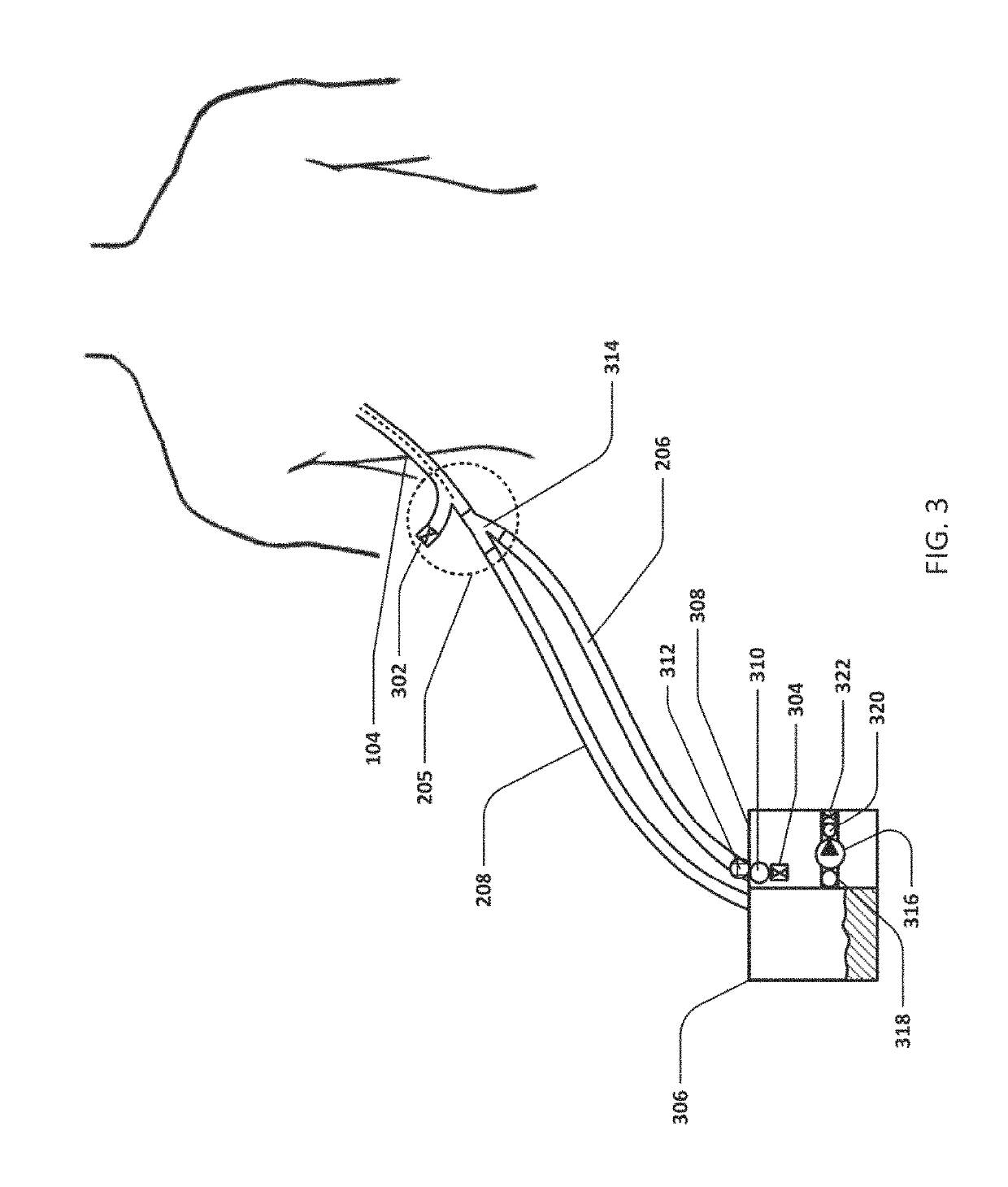 Devices and methods for managing chest drainage