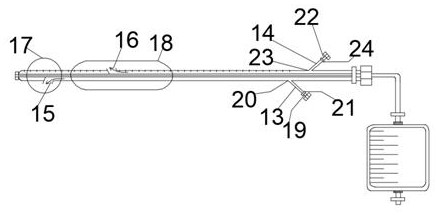 Disposable urethra balloon dilatation catheter